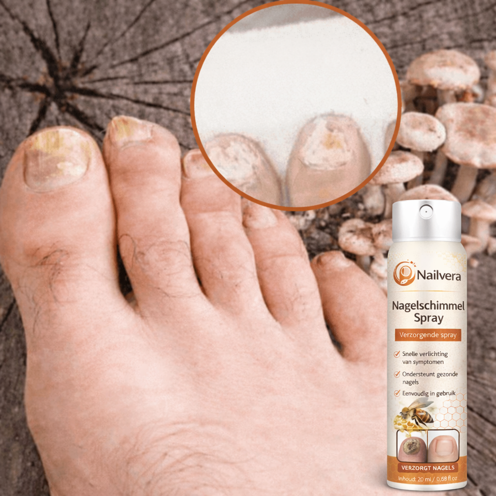 Nailvera™ – Spray voor gezonde en verzorgde nagels