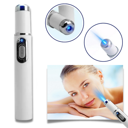 GlowRenew | Laserpen